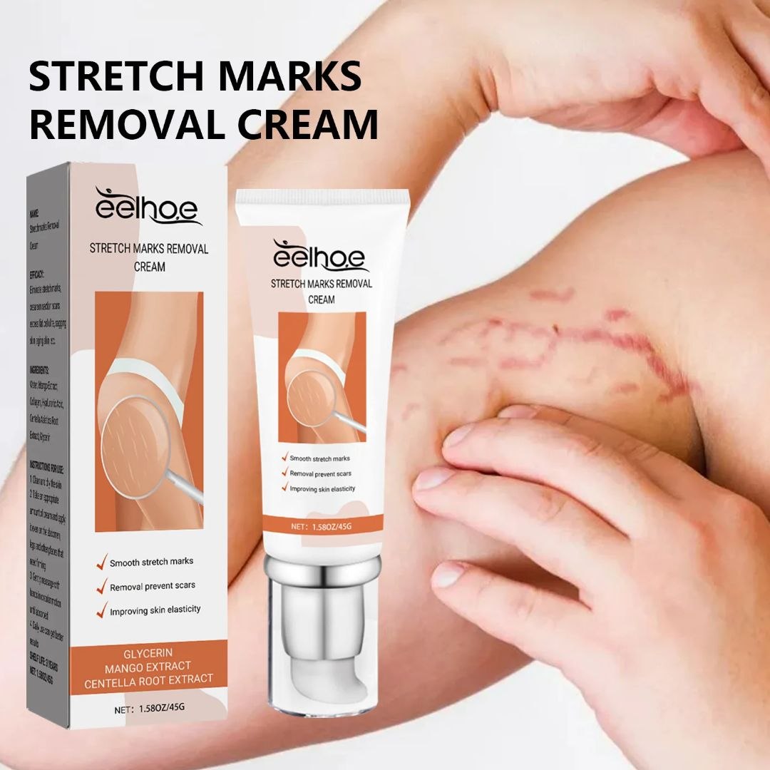 Eelhoe Stretch Marks Removal Cream - cicatrices bras