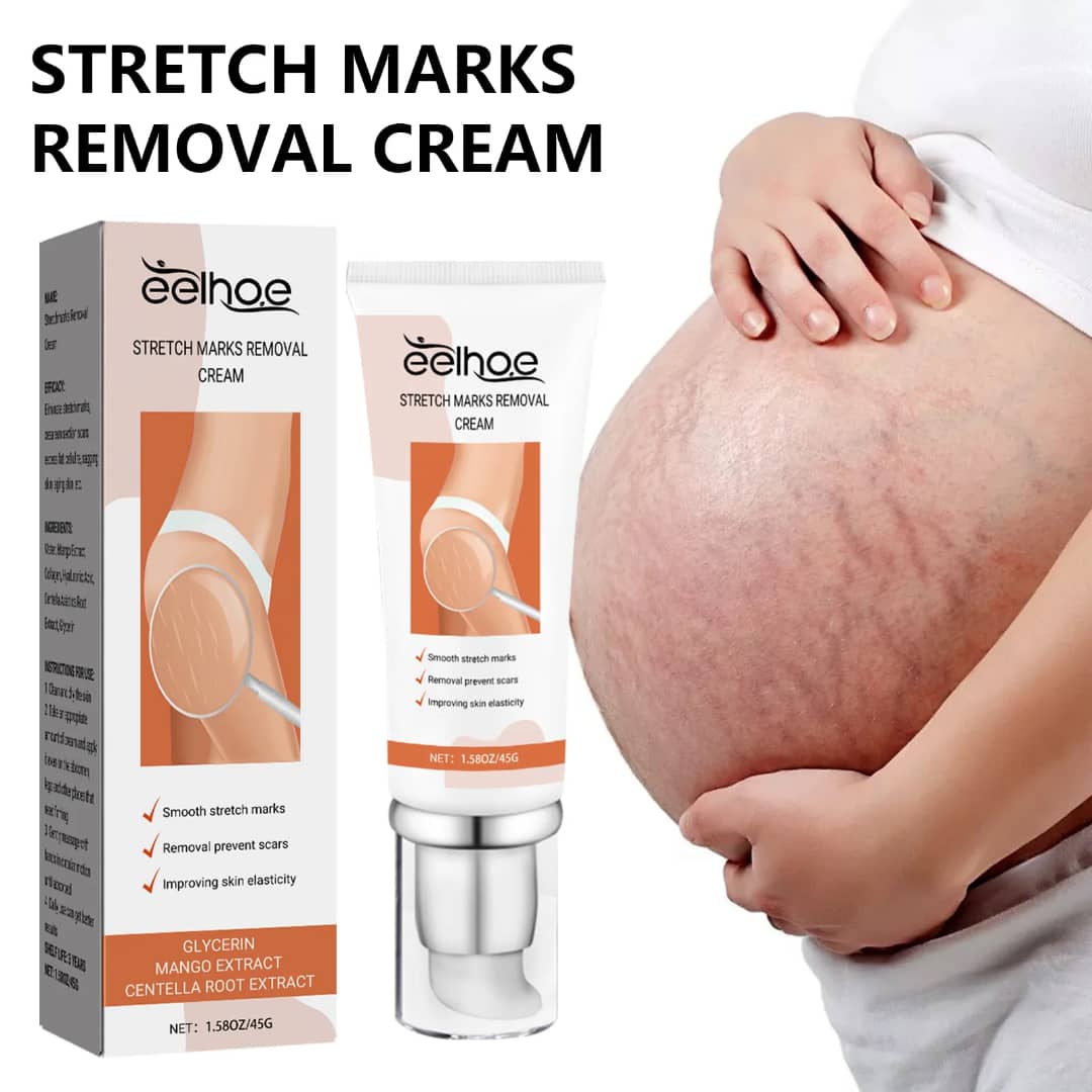 Eelhoe Stretch Marks Removal Cream - ventre grossesse